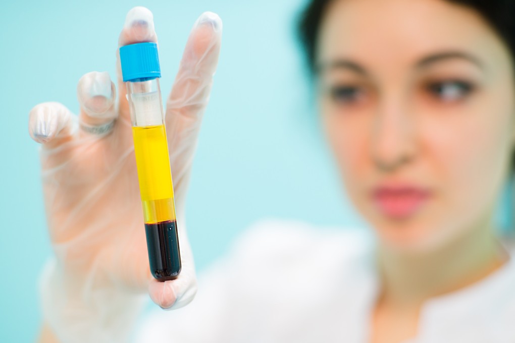 New blood tests developed in Hong Kong and the US deliver an easier, less invasive and more cost-effective way to detect Alzheimer’s disease early. Photo: Shutterstock