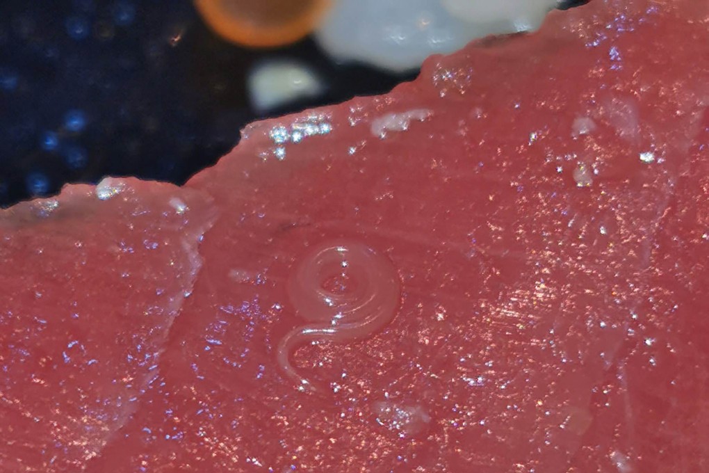 How do parasitic worms get in seafood? Here’s what you need to know South China Morning Post