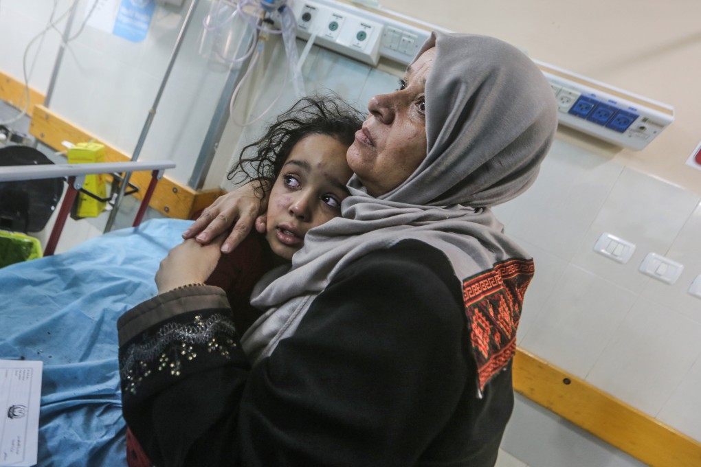 A mother comforts her injured child at Nasser Hospital on Wednesday after air strikes at Khan Yunis in the southern Gaza Strip. Photo: dpa