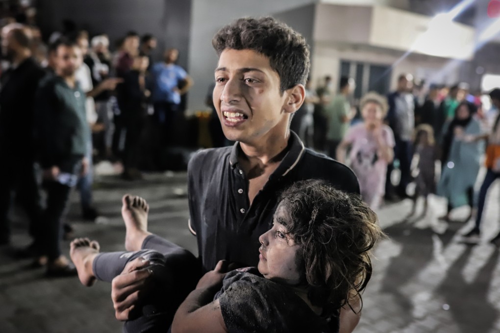 A Palestinian young man carries a child injured in a shelling on the Ahli Arab hospital in Gaza City. The lack of water and food in Gaza is inevitably affecting the young more immediately and more severely than adults. Photo: dpa