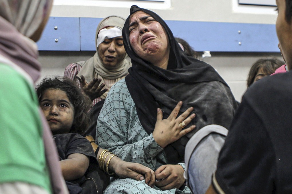 Wounded Palestinians at the al-Shifa hospital in Gaza City, after arriving from al-Ahli hospital following an explosion there that killed hundreds. Photo: AP