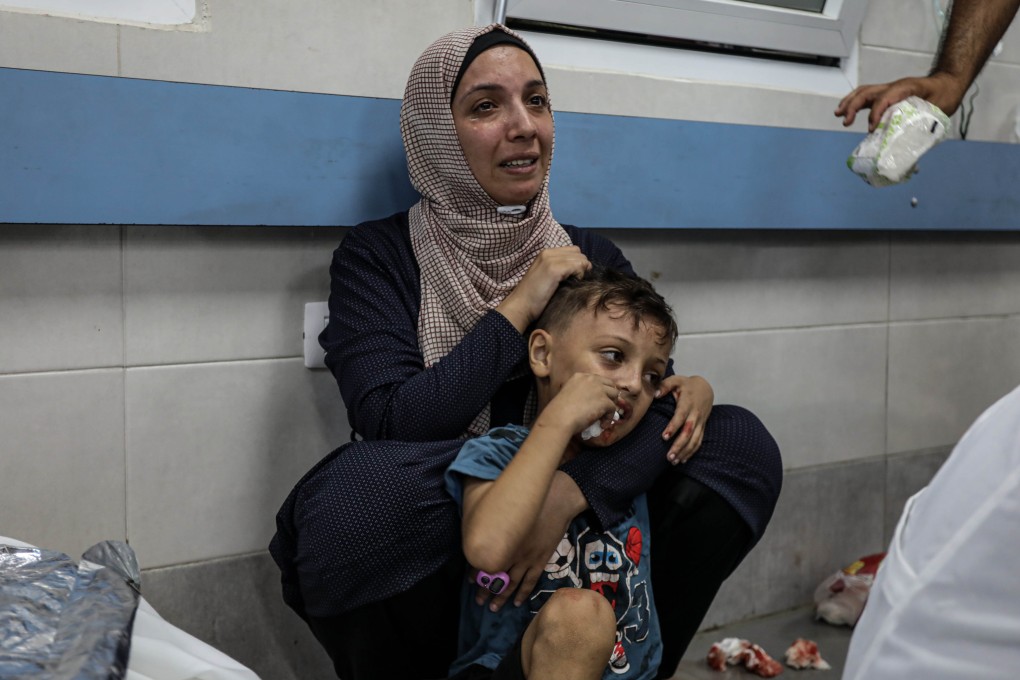 Injured people are treated at the Shifa Medical Complex in Gaza City, on Friday. Photo: Xinhua