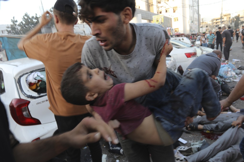 An injured Palestinian boy is carried from the ground following an Israeli airstrike outside the entrance of the al-Shifa hospital in Gaza City. Photo: AP