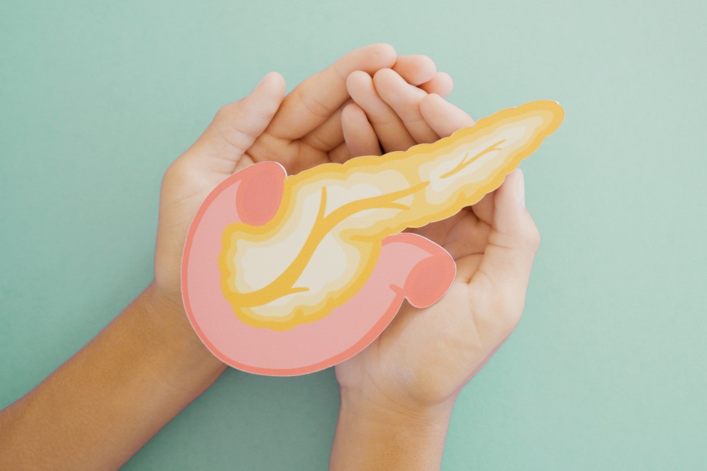 A breakthrough method of early screening for pancreatic cancer, which combines medical imaging with an AI algorithm, could help save thousands of lives each year. Photo: Shutterstock