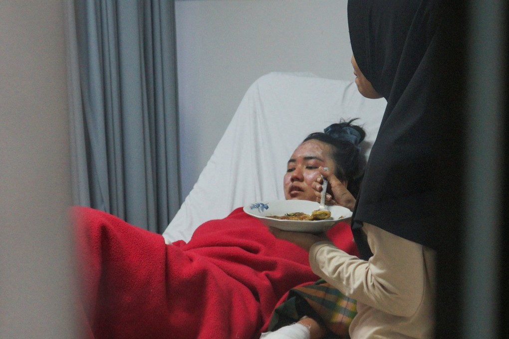 Tita Cahyani, a 25-year-old hiker who survived in Mount Marapi volcano eruption, rests while receiving treatment at a regional hospital. Photo: Reuters