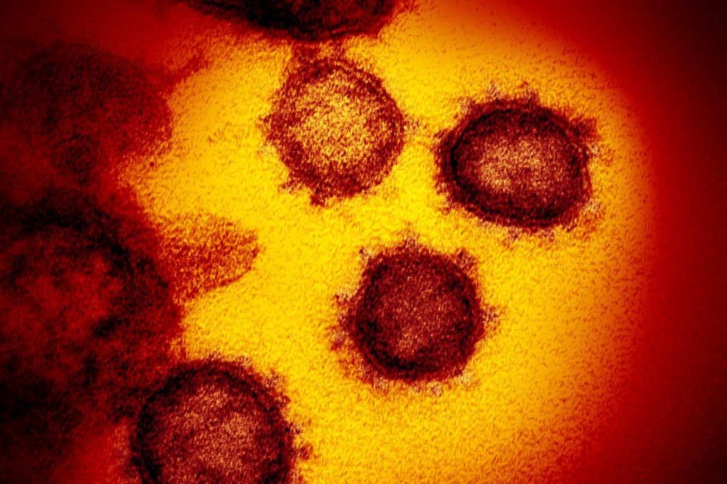 An electron microscope image of SARS-CoV-2, the virus that causes Covid-19. File photo: EPA-EFE