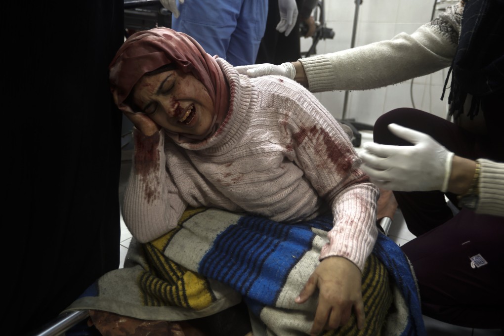 A wounded Palestinian woman receives treatment at the Nasser hospital in Khan Younis, southern Gaza Strip. Photo: AP