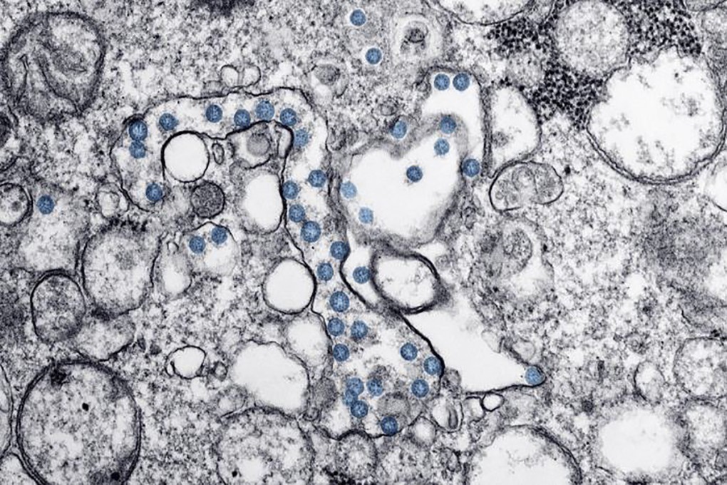 A microscopic image from February 2020, provided by the US Centres for Disease Control and Prevention, shows an isolate from the first US case of Covid-19. Photo: US Centres for Disease Control and Prevention via AFP