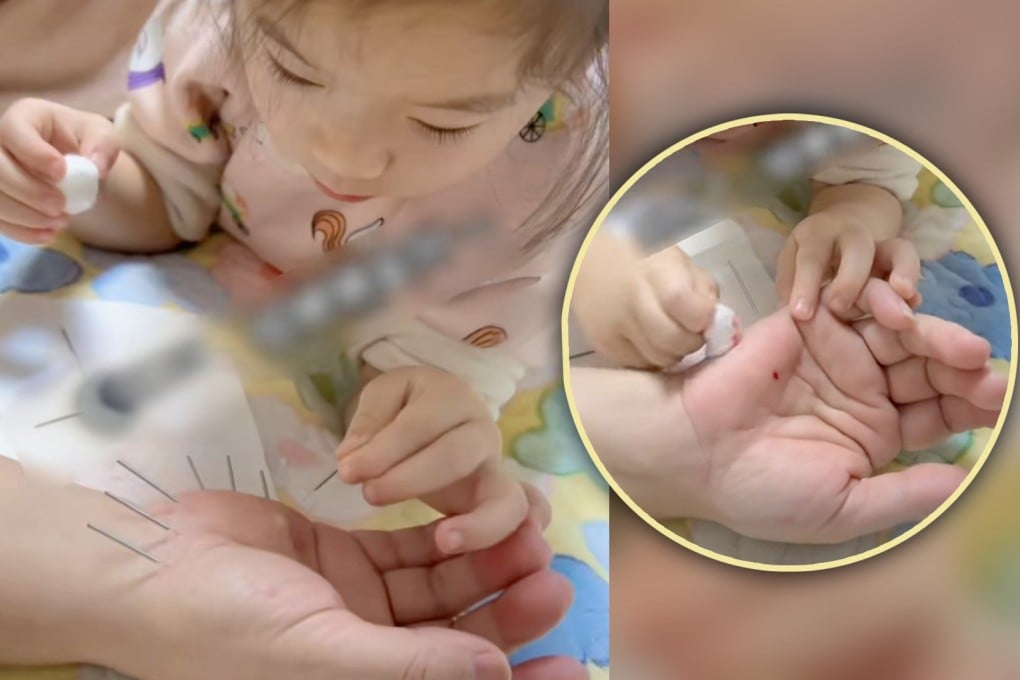 A five-year-old girl in China has stunned mainland social media by learning to practice Traditional Chinese Medicine acupuncture, and more, from her grandmother. Photo: SCMP composite/Douyin