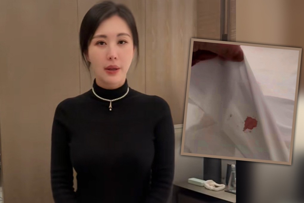 A top actress in China has spoken of her shock after discovering a blood-stained sheet and filthy toilet in her luxury hotel room, then being treated shabbily by staff when she complained.
Photo: SCMP composite/Douyin