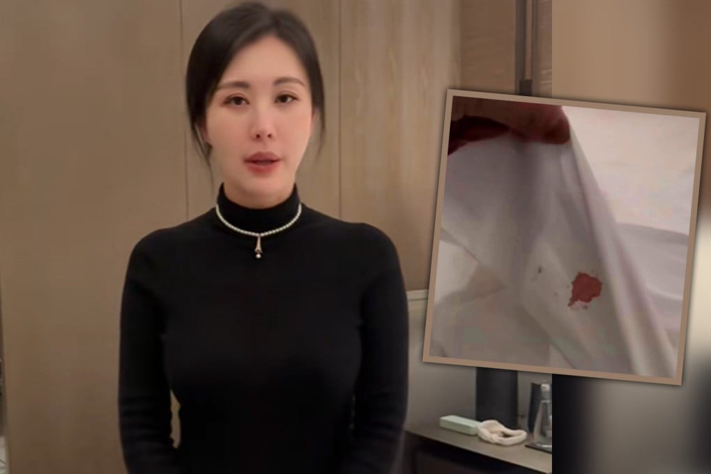 A top actress in China has spoken of her shock after discovering a blood-stained sheet and filthy toilet in her luxury hotel room, then being treated shabbily by staff when she complained.
Photo: SCMP composite/Douyin