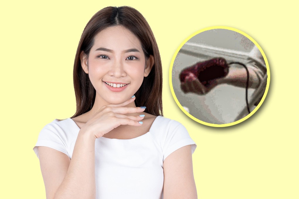 A new “blood purification” beauty treatment in China which involves the extraction and re-injection of plasma has raised health fears among experts and faced criticism on mainland social media. Photo: SCMP composite/Shutterstock/The Paper