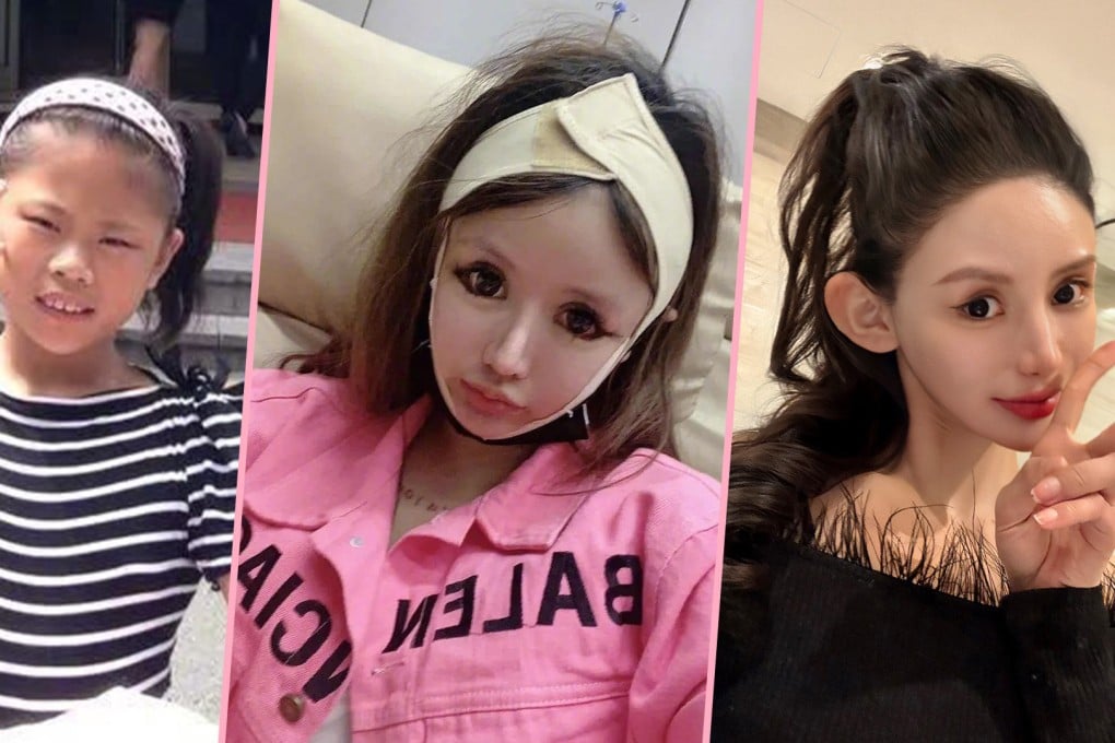 A teenager in China who has splurged US$563,000 of her parents’ money on plastic surgery in a bid to look like her favourite actress has been warned
by experts that one more operation could kill her. Photo: SCMP composite/Weibo