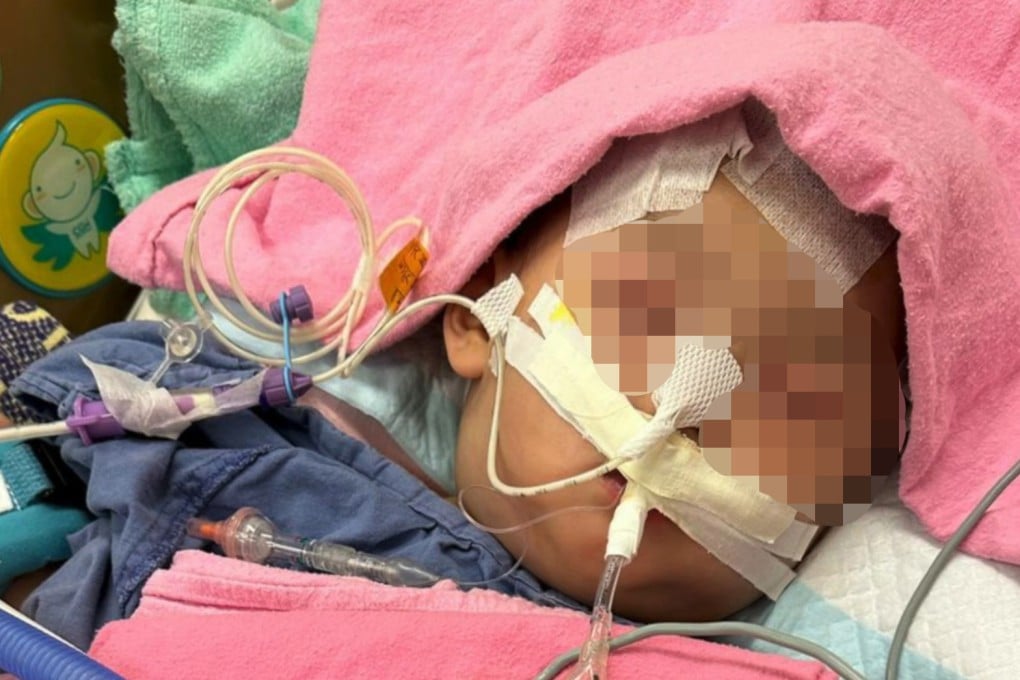 The parents of a baby who suffered serious brain injuries in January say she faces a life-threatening operation. Facebook / @(Catherine Lui )