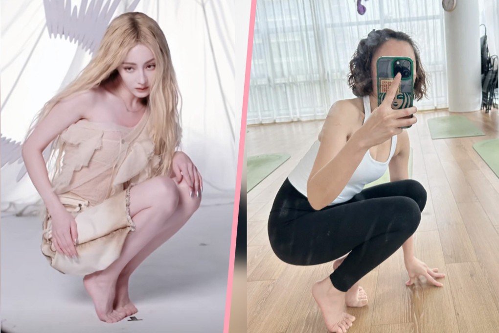 Health experts in China have warned that a new mainland craze of imitating a pose struck by famous Chinese actress, Dilraba Dilmurat (left), during a fashion photoshoot could cause injury. Photo: SCMP composite/Douyin/Xiaohongshu