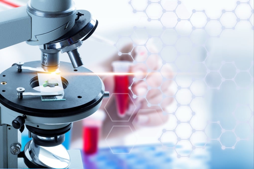 The connection between the gut microbiome and other organs in the body has been in the spotlight in recent decades. Photo: Shutterstock