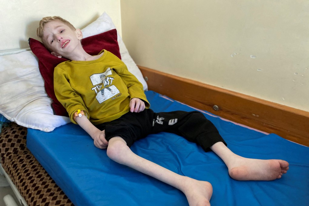 Malnourished Palestinian boy Fadi al-Zant lies on a bed at Kamal Adwan hospital, in northern Gaza. Photo: Reuters