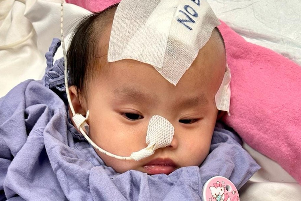 ‘Little Suet-yee’ in hospital. Her vision has also been impaired following major bleeding in her eyes from the injuries she suffered. Photo: Facebook/香港關懷力量