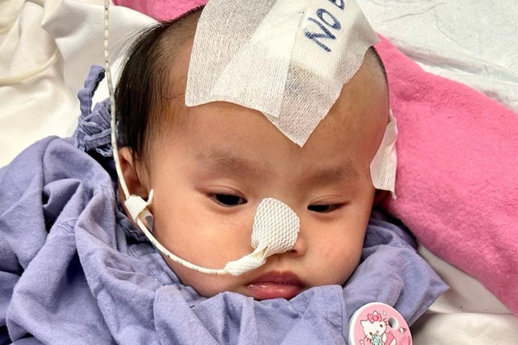 ‘Little Suet-yee’ in hospital. Her vision has also been impaired following major bleeding in her eyes from the injuries she suffered. Photo: Facebook/香港關懷力量