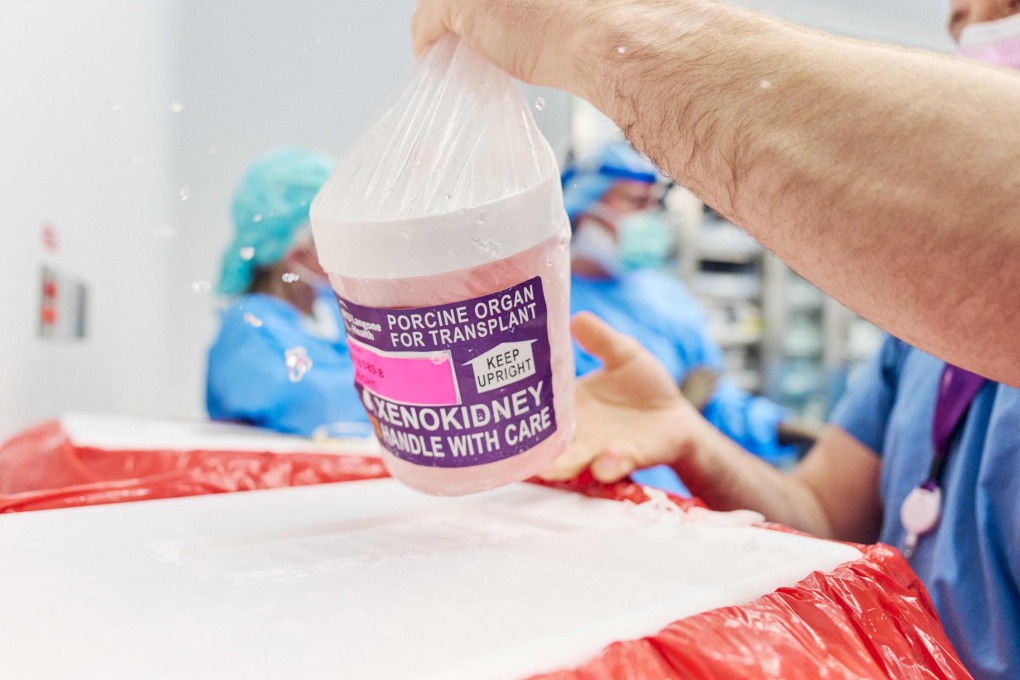 A gene-edited pig kidney is removed from a transport container at a hospital in New York last month. Photo: Joe Carrotta/NYU Langone Health/via AFP