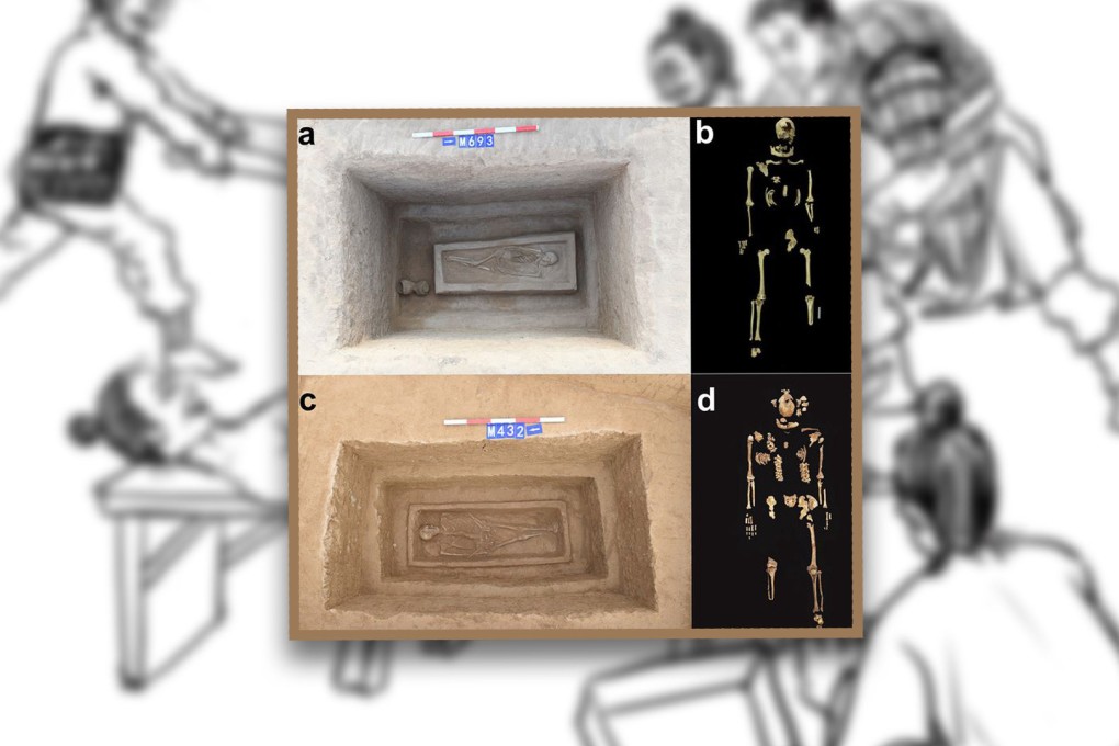 China’s 2,500-year-old skeletons with legs chopped off may be elites who received “cruel” punishment in ancient times. Photo: SCMP composite/Qian Wang/Texas A&M University