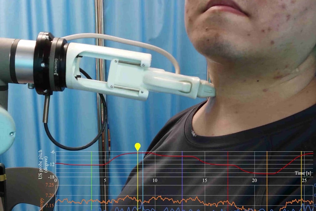 The AI-enabled robot is able to carry out thyroid scans while the patient is sitting down, and adjusts the position of the probe based on AI reasoning. Photo: SCUT