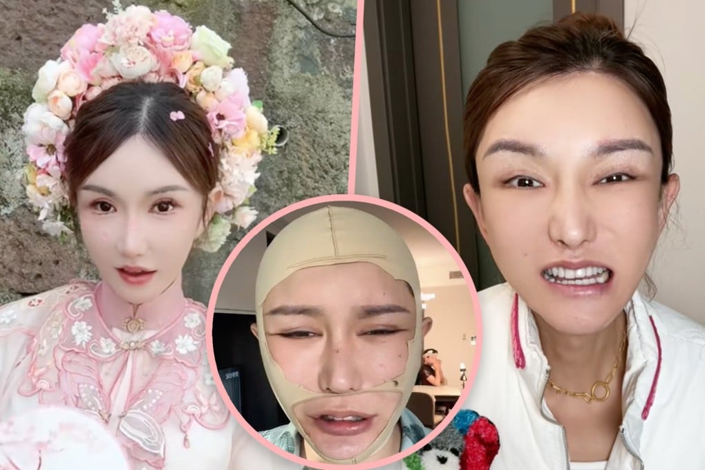 A transgender woman KOL in China has shocked her 2.2 million followers with deformities she suffered after botched plastic surgery which cost her US$183,000. Photo: SCMP composite/Douyin