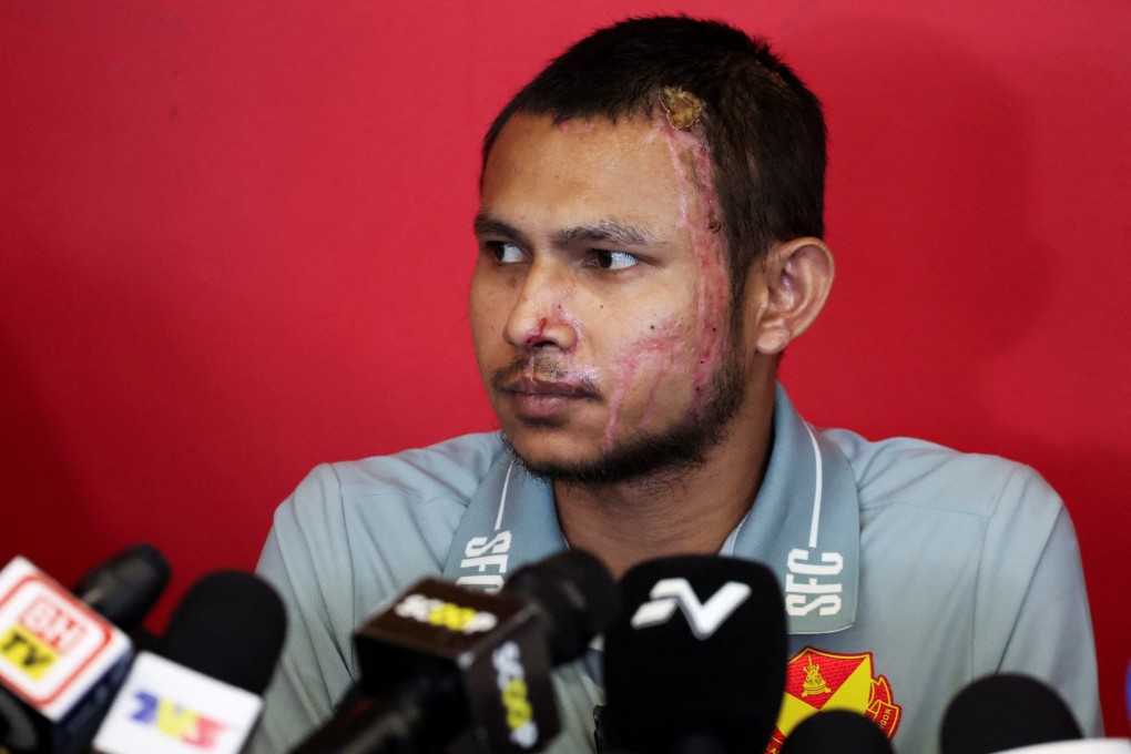 Malaysian footballer  Faisal Halim suffered fourth-degree burns in the acid attack at a shopping centre outside Kuala Lumpur. Photo: Reuters