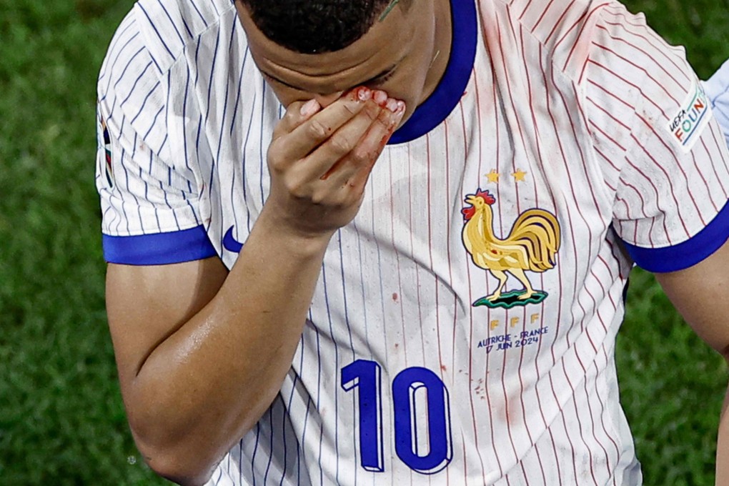 France’s Kylian Mbappe leaves the pitch after breaking his nose in a collision during the Group D match against Austria in Duesseldorf on Monday. Photo: AFP