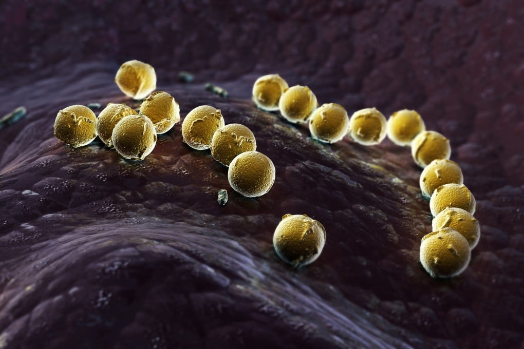 An infection of Streptococcus pyogenes can lead to mild and common illnesses, but in rare cases, the bacteria can cause life-threatening complications. Photo: Shutterstock