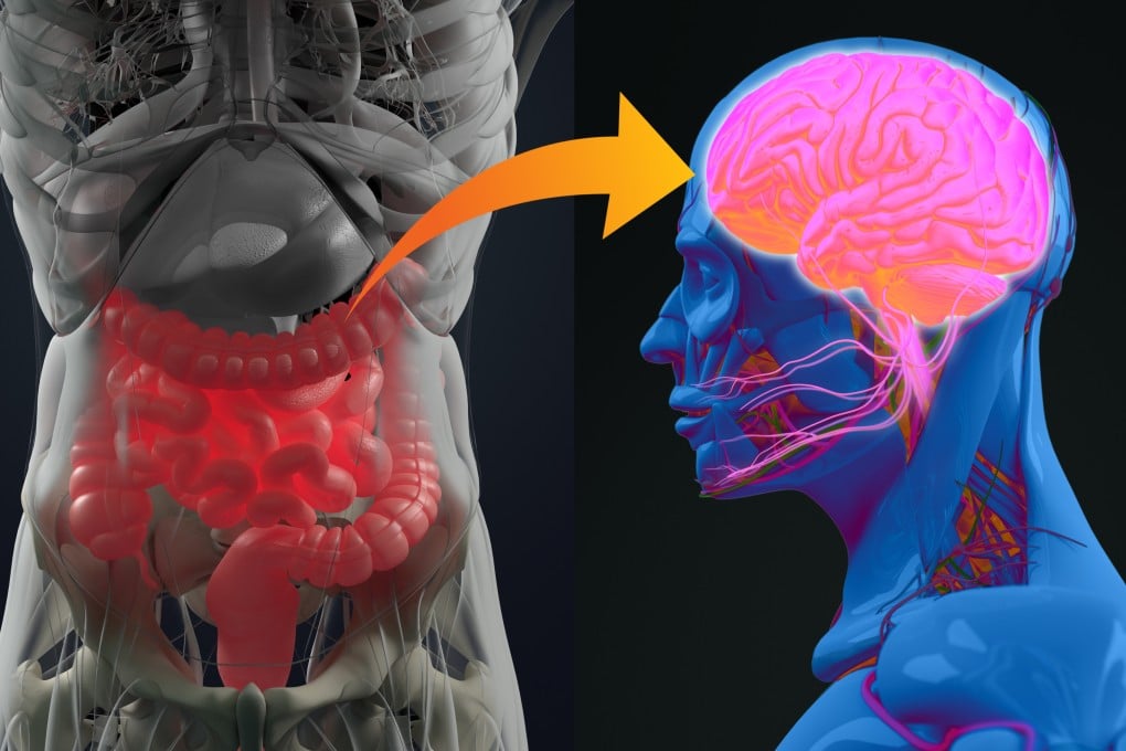 The gut and the brain are inextricably linked, and new studies shed more light on the relationship, showing food choices affect everything from decision-making to mental health conditions like bipolar disorder. Illustration: Shutterstock