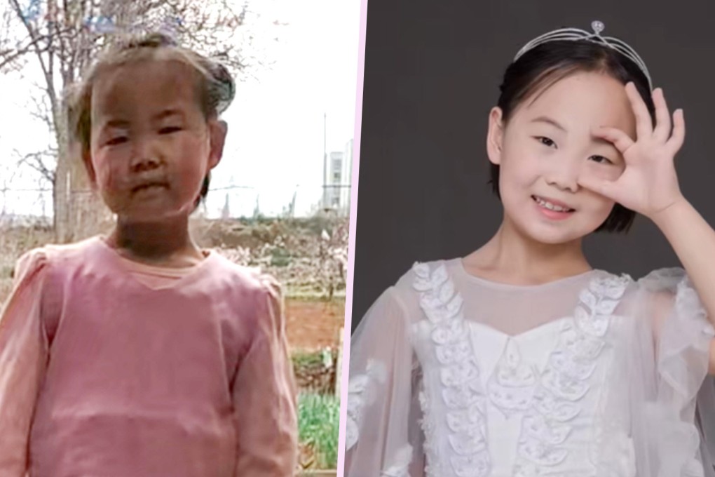 A sad and neglected little girl in China has undergone a remarkable change thanks to the love and care of her stepmother. Photo: SCMP composite/Douyin