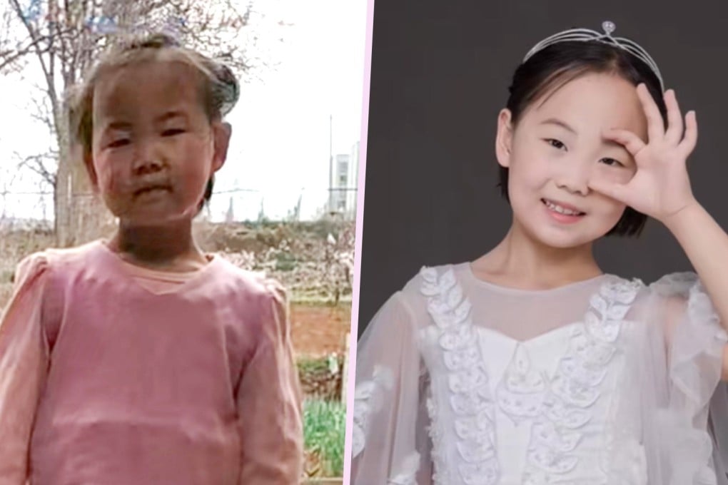 A sad and neglected little girl in China has undergone a remarkable change thanks to the love and care of her stepmother. Photo: SCMP composite/Douyin