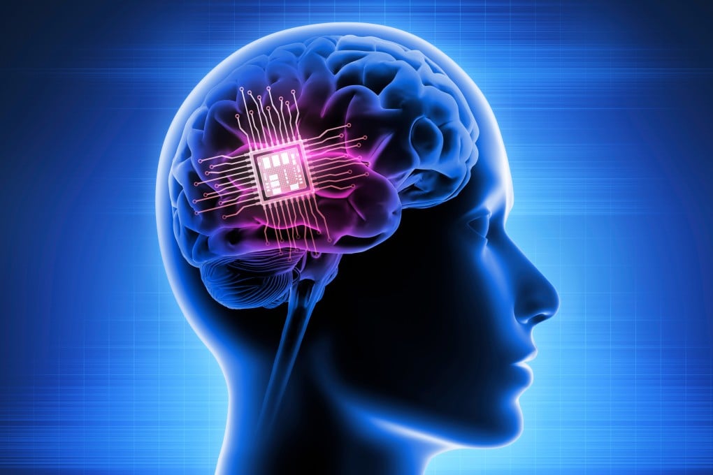 Brain-computer interface technology’s revolutionary potential in the medical and healthcare industry includes restoring a sense of sight for the blind and mobility for paralysed patients. Photo: Shutterstock