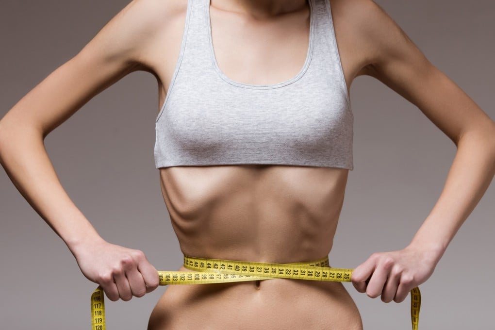 Researchers warned there must be “effective controls” put in place to stop what they describe as “pro-anorexia” content circulating on TikTok. Photo: Shutterstock