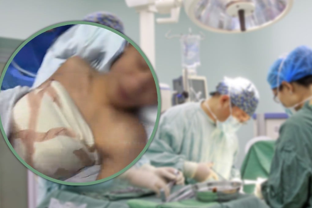 A beauty clinic in China has been widely criticised for performing breast enlargement surgery on a teenage boy with a mental age of five. Photo: SCMP composite/Shutterstock/Douyin