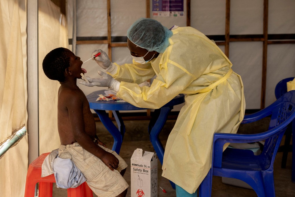 A nurse takes a sample from a child suspected to have mpox at the treatment centre in Munigi in the Democratic Republic of the Congo in July. Photo: Reuters