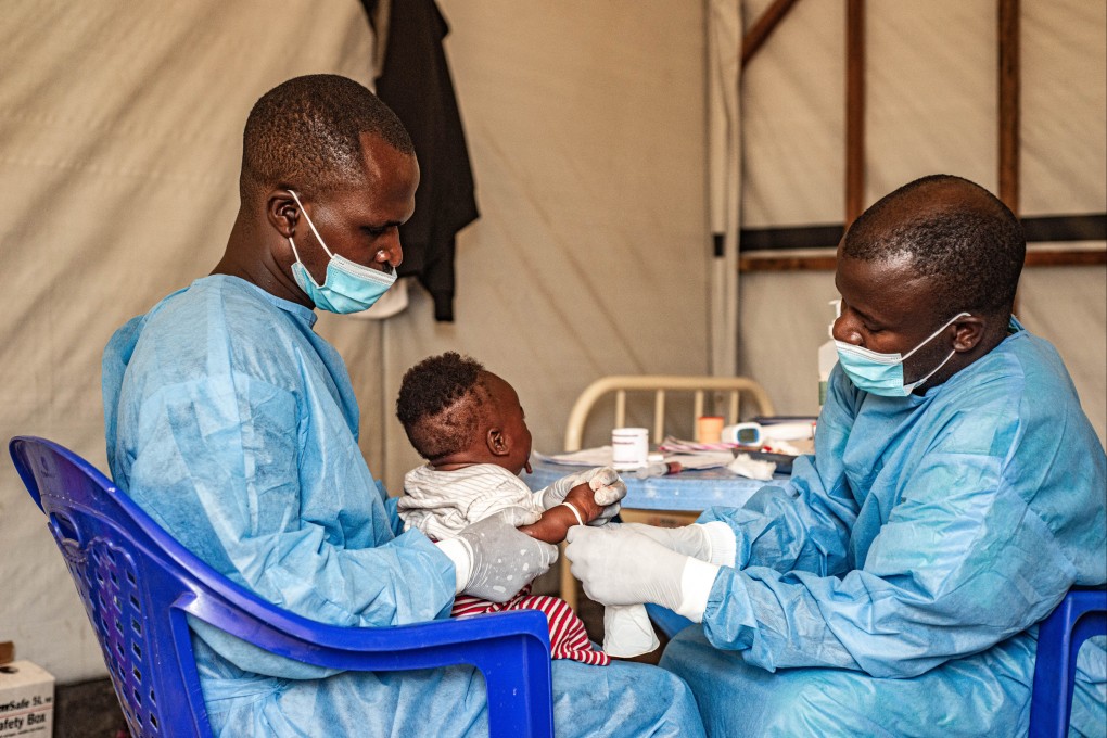 A child infected with mpox undergoes treatment at a hospital in North Kivu province, eastern Democratic Republic of the Congo, on August 15. Photo: Xinhua