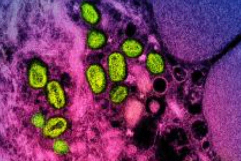 A colourised transmission electron micrograph shows mpox particles (green) found within an infected cell (pink and purple). Image: US National Institute of Allergy and Infectious Diseases via AFP