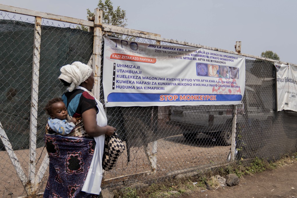 A woman walks past a sign that reads stop monkeypox at a clinic in Munigi, eastern Congo, Friday, August 16. Photo: AP