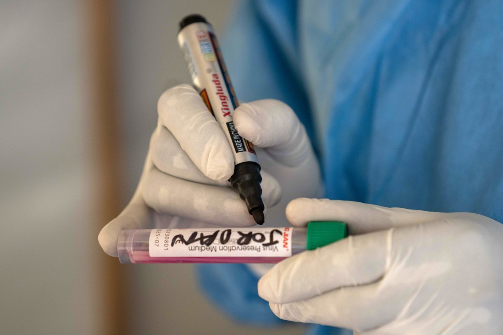 A medical staff labels an mpox sample taken from a patient in the Democratic Republic of the Congo on August 19. Photo: EPA-EFE