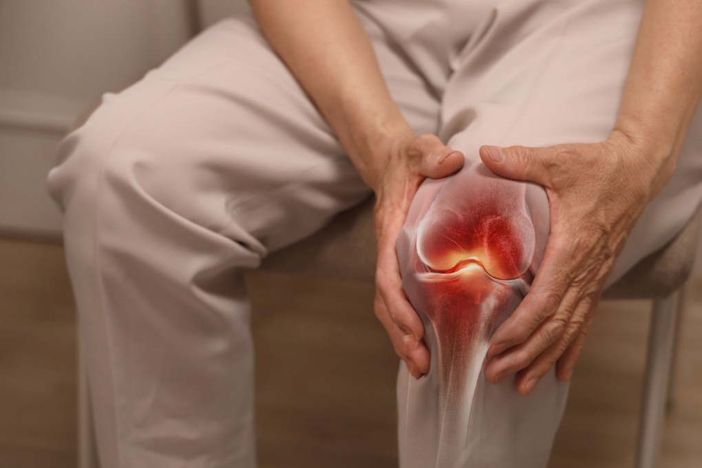 Reduced lubrication of cartilage is thought to be a major factor in triggering osteoarthritis, a degenerative joint disease causing pain, swelling and stiffness that often reduce mobility. Photo: Shutterstock