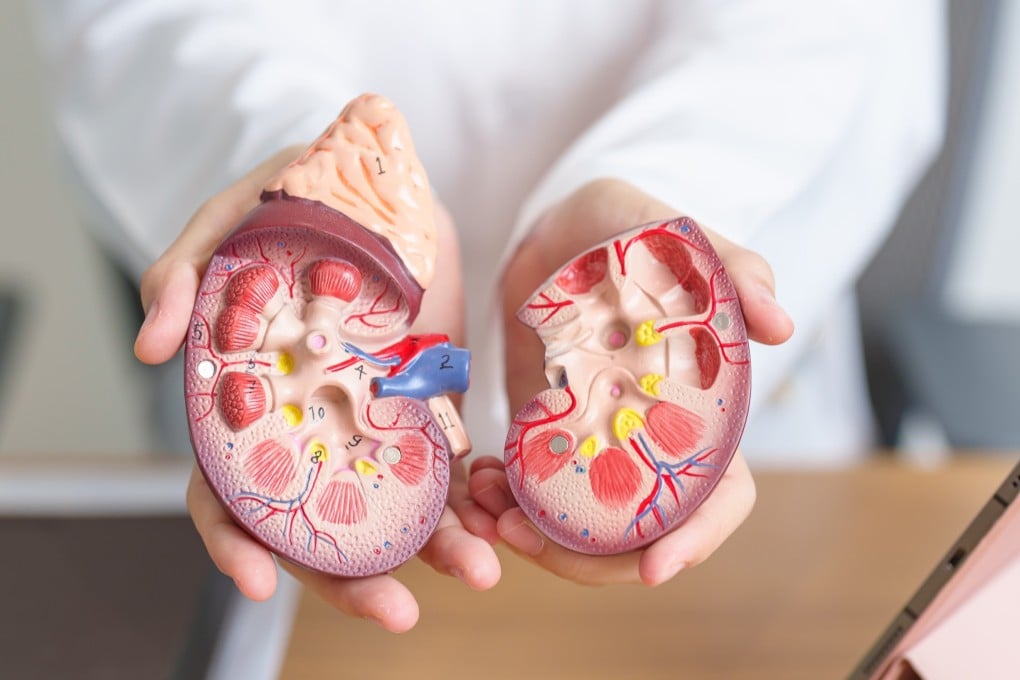 A kidney donor’s risk of dying as a result of surgery to remove the organ has reached a new low of less than one in 10,000, and the remaining kidney grows to meet the body’s needs, experts say. Photo: Shutterstock