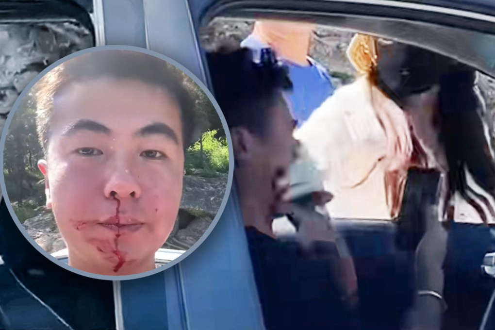 A Chinese female driver is facing online backlash for repeatedly punching a non-retaliating ex-soldier after she tried to cut in line. Photo: SCMP composite/Douyin