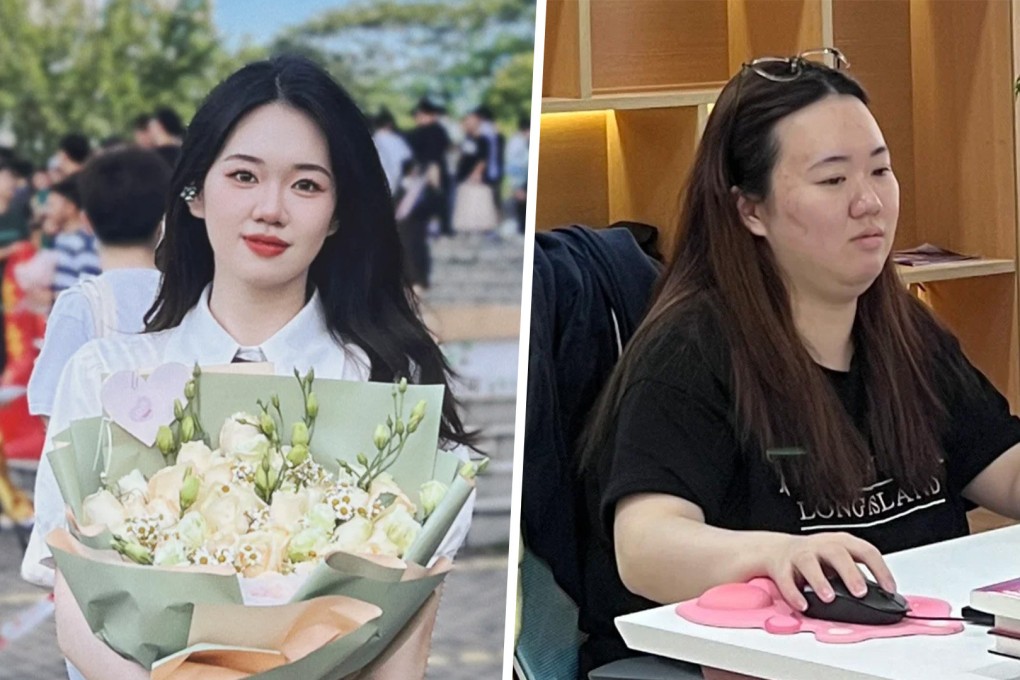 A Chinese woman gained 20kg from work stress but transformed notably after quitting her job. Photo: SCMP composite/Xiaohongshu