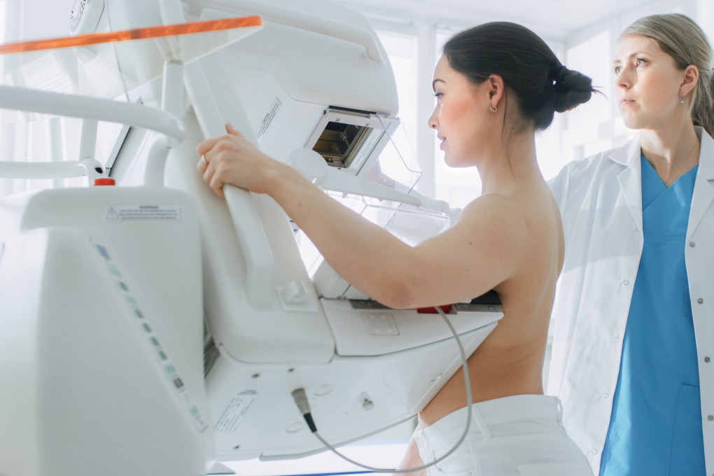 A woman has a mammogram screening, checking her for breast cancer. Photo: Shutterstock