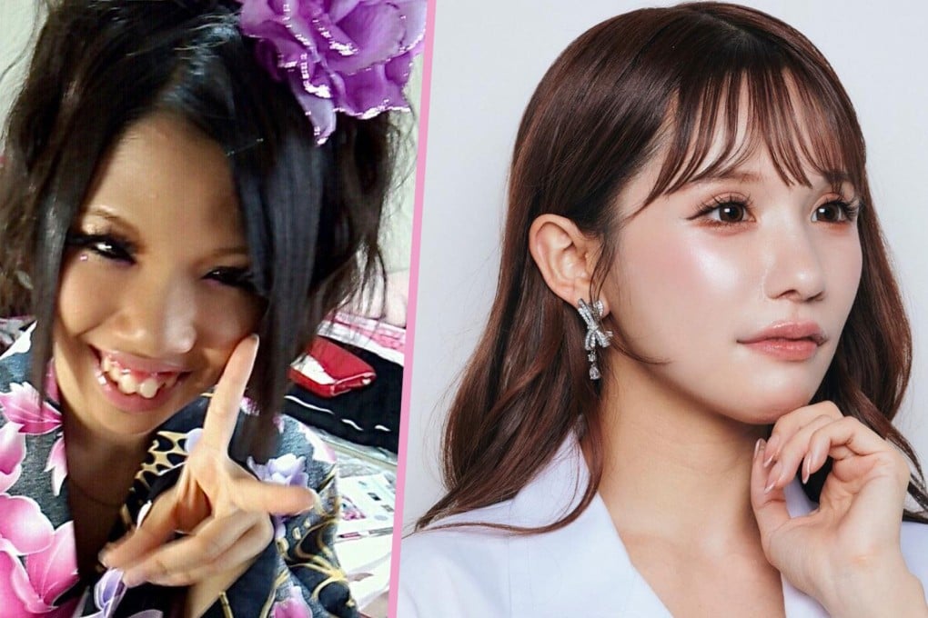 A Japanese woman has amassed over 1 million online fans by sharing her extensive cosmetic surgery journey.
Photo: SCMP composite/X.com/IG@nyairin_18