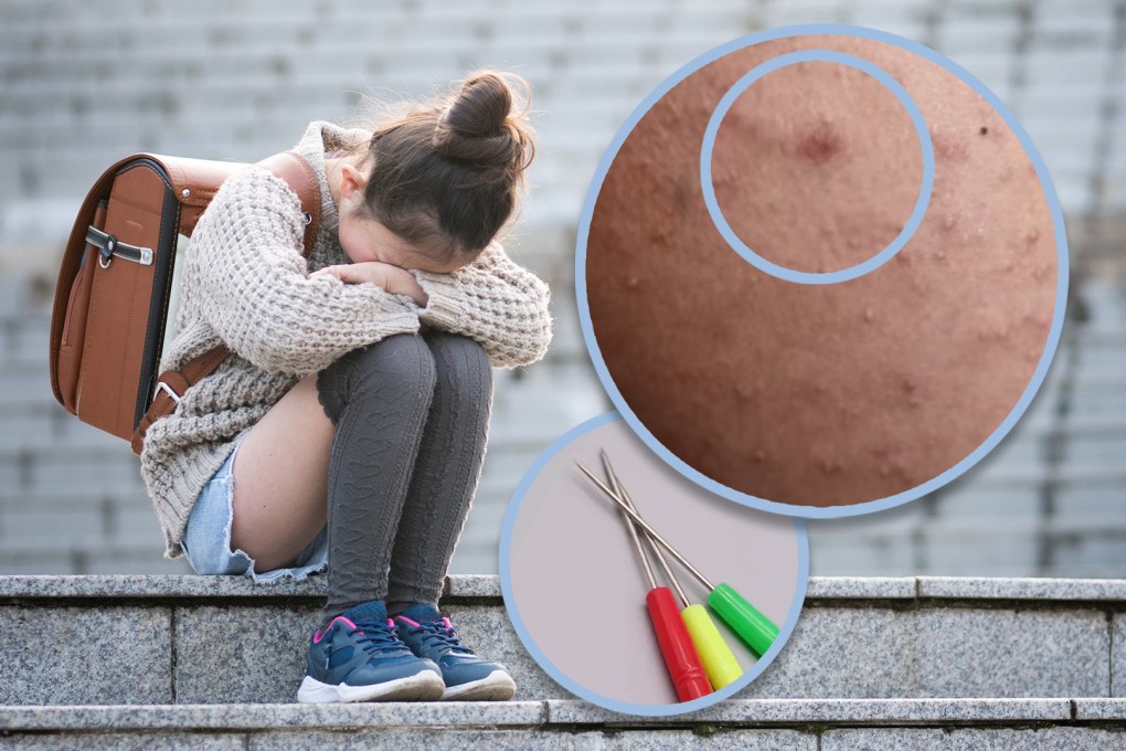 Outrage has erupted in China after officials claimed that a boy who stabbed his classmate over 200 times with a sewing awl did not meet the standards of bullying. Photo: SCMP composite/Shutterstock/QQ.com/Taobao