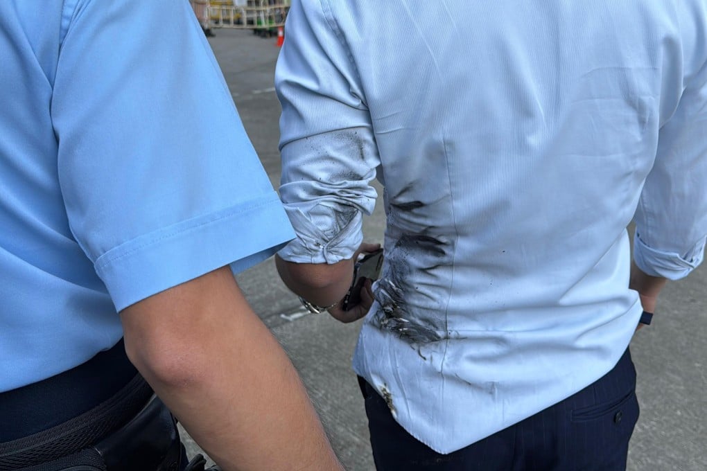 A man was injured after a lithium battery caught fire. Photo: Handout