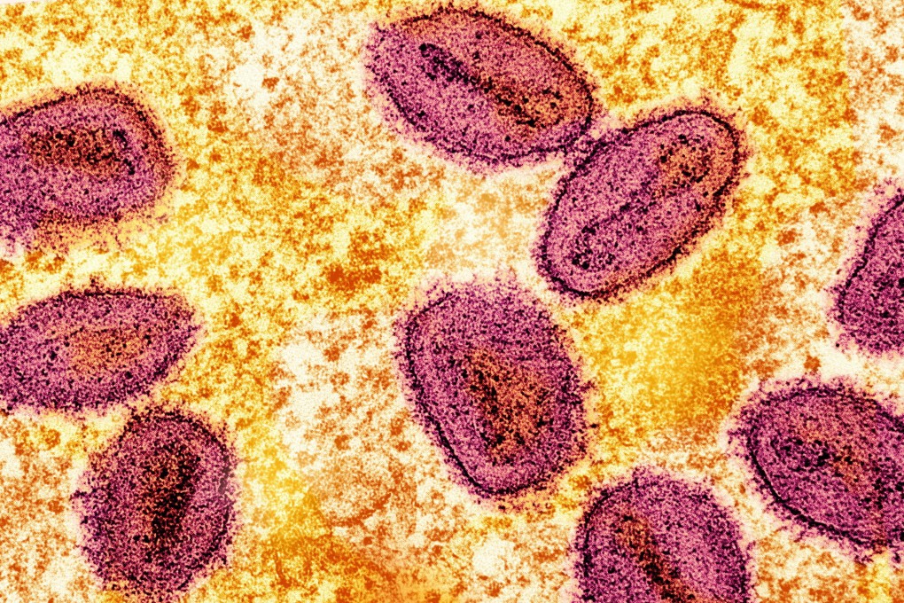 A colourized transmission electron micrograph shows mpox virus particles (pink) found within an infected cell (yellow). Image: National Institute of Allergy and Infectious Diseases via Reuters